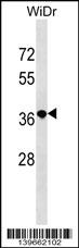 TIF-IA / RRN3 Antibody - RN3L1 Antibody (C-term) western blot analysis in WiDr cell line lysates (35ug/lane).This demonstrates the RN3L1 antibody detected the RN3L1 protein (arrow).