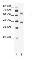 TIF-IA / RRN3 Antibody - A: Marker, B: Jurkat Cell Lysate.  This image was taken for the unconjugated form of this product. Other forms have not been tested.