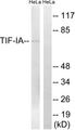 TIF-IA / RRN3 Antibody - Western blot analysis of lysates from HeLa cells, treated with calyculinA 50ng/ml 30', using TIF-IA Antibody. The lane on the right is blocked with the synthesized peptide.