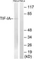 TIF-IA / RRN3 Antibody - Western blot analysis of extracts from HeLa cells, treated with calyculinA (50ng/ml, 30mins), using TIF-IA (Ab-649) antibody.