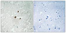 TIF-IA / RRN3 Antibody - Immunohistochemistry analysis of paraffin-embedded human brain, using TIF-IA (Phospho-Ser649) Antibody. The picture on the right is blocked with the phospho peptide.