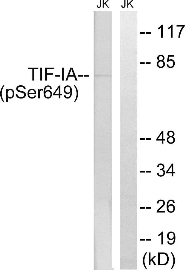 TIF-IA / RRN3 Antibody - Western blot analysis of lysates from Jurkat cells treated with starved 24h, using TIF-IA (Phospho-Ser649) Antibody. The lane on the right is blocked with the phospho peptide.