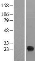 TIFA Protein - Western validation with an anti-DDK antibody * L: Control HEK293 lysate R: Over-expression lysate