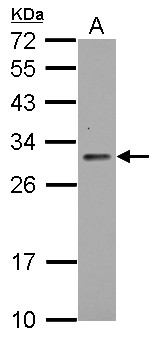 TIGAR Antibody - Sample (30 ug of whole cell lysate) A: Raji 12% SDS PAGE C12orf5 / TIGAR antibody diluted at 1:2000