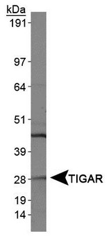 TIGAR Antibody - Western Blot: TIGAR Antibody - Analysis of TIGAR in HeLa whole cell extracts.  This image was taken for the unconjugated form of this product. Other forms have not been tested.