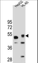 TIGD3 Antibody - TIGD3 Antibody western blot of HepG2 and HL-60 cell line lysates (35 ug/lane). The TIGD3 antibody detected the TIGD3 protein (arrow).