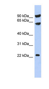 TIGD3 Antibody - TIGD3 antibody Western blot of PANC1 cell lysate. This image was taken for the unconjugated form of this product. Other forms have not been tested.