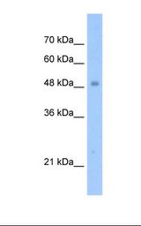 TIGD3 Antibody - Jurkat cell lysate. Antibody concentration: 1.25 ug/ml. Gel concentration: 12%.  This image was taken for the unconjugated form of this product. Other forms have not been tested.