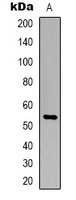 TIGD3 Antibody - Western blot analysis of TIGD3 expression in Jurkat (A) whole cell lysates.