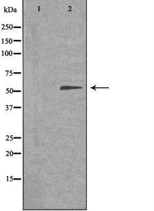 TIGD3 Antibody - Western blot analysis of extracts of COLO205 cells using TIGD3 antibody. The lane on the left is treated with the antigen-specific peptide.