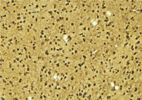 TIGD3 Antibody - 1:100 staining mouse brain tissue by IHC-P. The sample was formaldehyde fixed and a heat mediated antigen retrieval step in citrate buffer was performed. The sample was then blocked and incubated with the antibody for 1.5 hours at 22°C. An HRP conjugated goat anti-rabbit antibody was used as the secondary.