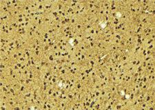 TIGD3 Antibody - 1:100 staining mouse brain tissue by IHC-P. The sample was formaldehyde fixed and a heat mediated antigen retrieval step in citrate buffer was performed. The sample was then blocked and incubated with the antibody for 1.5 hours at 22°C. An HRP conjugated goat anti-rabbit antibody was used as the secondary.