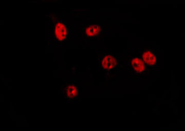 TIGD3 Antibody - Staining HepG2 cells by IF/ICC. The samples were fixed with PFA and permeabilized in 0.1% Triton X-100, then blocked in 10% serum for 45 min at 25°C. The primary antibody was diluted at 1:200 and incubated with the sample for 1 hour at 37°C. An Alexa Fluor 594 conjugated goat anti-rabbit IgG (H+L) Ab, diluted at 1/600, was used as the secondary antibody.