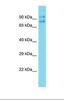 TIGD5 Antibody - Western blot of Mouse Liver. Tigd5 antibody dilution 1.0 ug/ml.  This image was taken for the unconjugated form of this product. Other forms have not been tested.