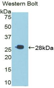 TIGIT Antibody - Western blot of recombinant TIGIT.  This image was taken for the unconjugated form of this product. Other forms have not been tested.