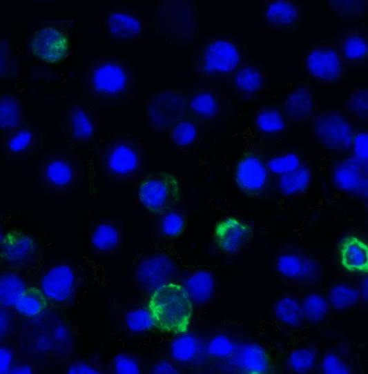 TIGIT Antibody - Immunofluorescence of TIGIT in over expressing HEK293 cells using TIGIT Antibody at 1 ug/ml. Green: TIGIT Antibody [10B1] Blue: DAPI staining