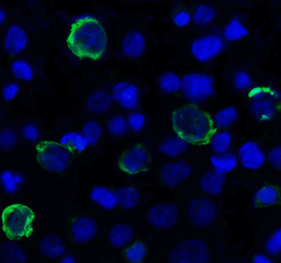 TIGIT Antibody - Immunofluorescence of TIGIT in over expressing HEK293 cells using TIGIT Antibody at 1 ug/ml. Green: TIGIT Antibody [4A10] Blue: DAPI staining