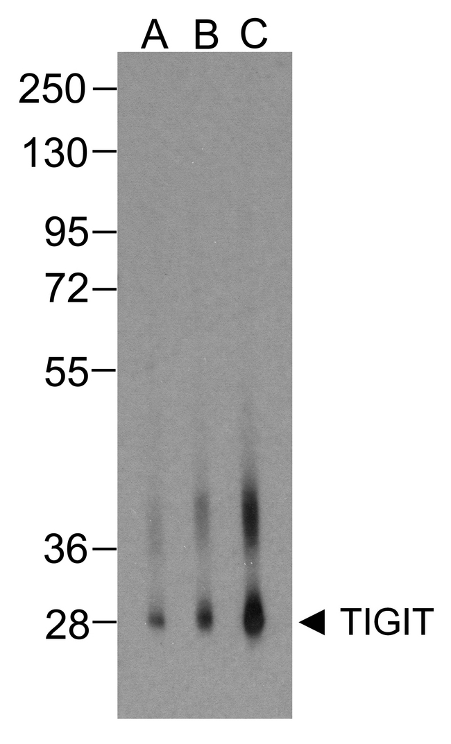 TIGIT Antibody - Western blot analysis of TIGIT in over expressing HEK293 cells using RF16054 antibody at (A) 0.25 ug/ml , (B) 0.5 ug/ml, and (C) 1 ug/ml.
