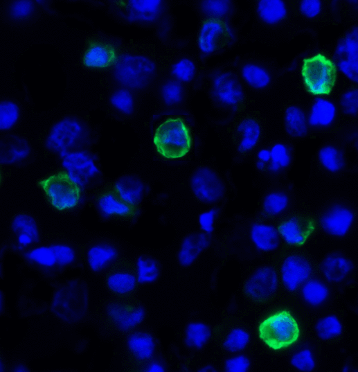 TIGIT Antibody - Immunofluorescence of TIGIT in over expressing HEK293 cells using TIGIT Antibody at 1 ug/ml. Green: TIGIT Antibody [4A11] Blue: DAPI staining
