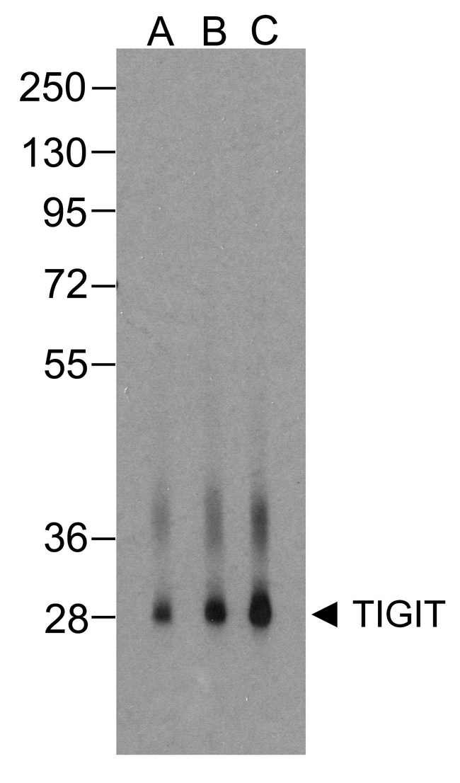TIGIT Antibody - Western blot analysis of TIGIT in over expressing HEK293 cells using RF16055 antibody at (A) 0.25 ug/ml , (B) 0.5 ug/ml, and (C) 1 ug/ml.