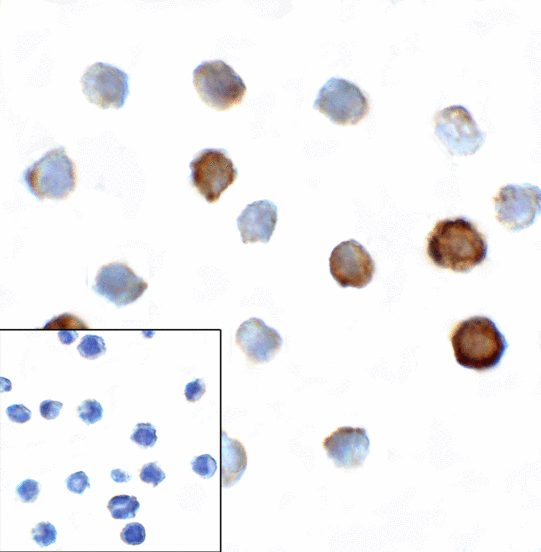 TIGIT Antibody - Immunocytochemistry of TIGIT in over expressing HEK293 cells using TIGIT antibody and control mouse IgG antibody (left corner box) at 1 ug/ml.