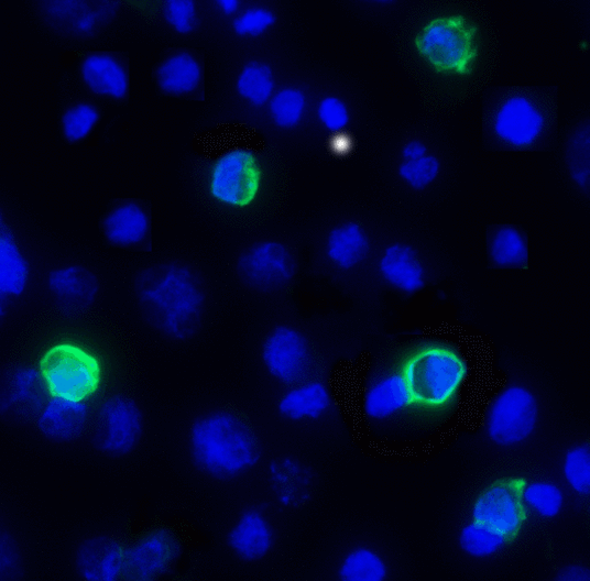 TIGIT Antibody - Immunofluorescence of TIGIT in over expressing HEK293 cells using TIGIT Antibody at 1 ug/ml. Green: TIGIT Antibody [4A12] Blue: DAPI staining