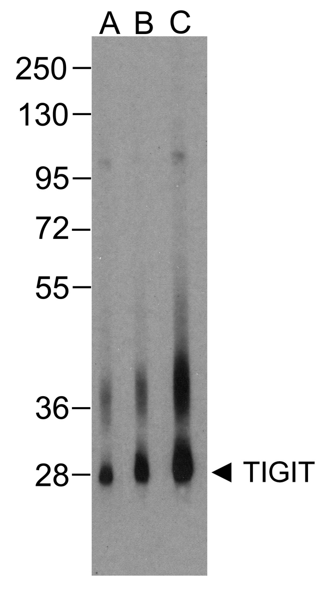 TIGIT Antibody - Western blot analysis of TIGIT in over expressing HEK293 cells using RF16056 antibody at (A) 0.25 ug/ml , (B) 0.5 ug/ml, and (C) 1 ug/ml.