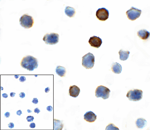 TIGIT Antibody - Immunocytochemistry of TIGIT in over expressing HEK293 cells using TIGIT antibody and control mouse IgG antibody (left corner box) at 1 ug/ml.