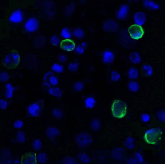 TIGIT Antibody - Immunofluorescence of TIGIT in over expressing HEK293 cells using TIGIT Antibody at 1 ug/ml. Green: TIGIT Antibody [7E5] Blue: DAPI staining