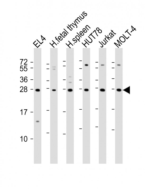 TIGIT Antibody - All lanes: Anti-TIGIT Antibody at 1:2000 dilution Lane 1: EL4 whole cell lysate Lane 2: human fetal thymus lysate Lane 3: human spleen lysate Lane 4: HUT78 whole cell lysate Lane 5: Jurkat whole cell lysate Lane 6: MOLT-4 whole cell lysate Lysates/proteins at 20 µg per lane. Secondary Goat Anti-Rabbit IgG, (H+L), Peroxidase conjugated at 1/10000 dilution. Predicted band size: 26 kDa Blocking/Dilution buffer: 5% NFDM/TBST.