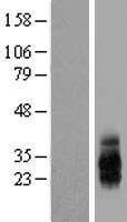 TIGIT Protein - Western validation with an anti-DDK antibody * L: Control HEK293 lysate R: Over-expression lysate
