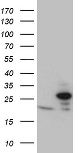 TIM23 Antibody - HEK293T cells were transfected with the pCMV6-ENTRY control. (Left lane) or pCMV6-ENTRY TIMM23. (Right lane) cDNA for 48 hrs and lysed. Equivalent amounts of cell lysates. (5 ug per lane) were separated by SDS-PAGE and immunoblotted with anti-TIMM23. (1:2000)