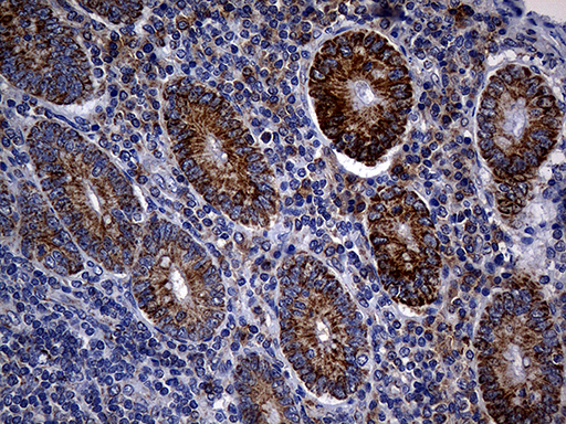 TIM23 Antibody - Immunohistochemical staining of paraffin-embedded Human appendix tissue within the normal limits using anti-TIMM23 mouse monoclonal antibody. (Heat-induced epitope retrieval by Tris-EDTA(1:2000)