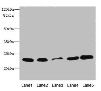 TIM23 Antibody - Western blot All Lanes: TIMM23 antibody at 3.03ug/ml Lane 1: Mouse heart tissue Lane 2: Mouse liver tissue Lane 3: A431 whole cell lysate Lane 4: MCF7 whole cell lysate Lane 5: Jurkat whole cell lysate Secondary Goat polyclonal to rabbit IgG at 1/10000 dilution Predicted band size: 22 kDa Observed band size: 22 kDa