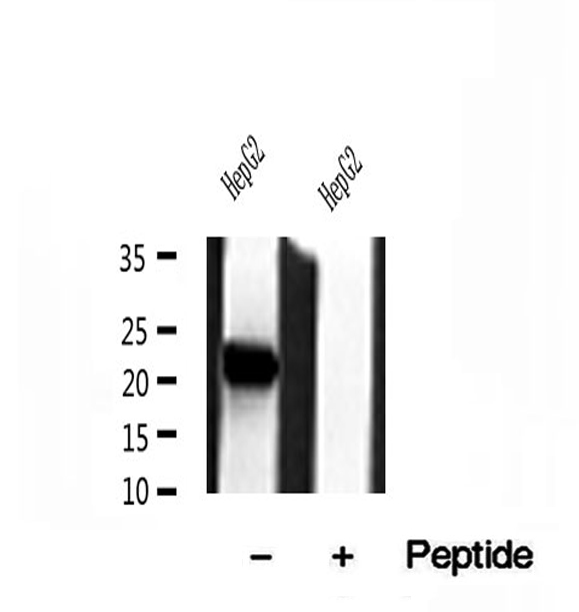 TIM23 Antibody - Western blot analysis of extracts of HepG2 cells using Tim23 antibody.