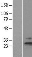 TIM23 Protein - Western validation with an anti-DDK antibody * L: Control HEK293 lysate R: Over-expression lysate