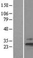 TIM23 Protein - Western validation with an anti-DDK antibody * L: Control HEK293 lysate R: Over-expression lysate