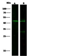 TIMD4 / TIM4 / TIM-4 Antibody - Anti-TIMD4 rabbit polyclonal antibody at 1:500 dilution. Lane A: 293T Whole Cell Lysate. Lane B: Jurkat Whole Cell Lysate. Lysates/proteins at 30 ug per lane. Secondary: Goat Anti-Rabbit IgG H&L (Dylight800) at 1/10000 dilution. Developed using the Odyssey technique. Performed under reducing conditions. Predicted band size: 37 kDa. Observed band size: 42 kDa.