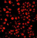 TIMELESS Antibody - Detection of Human Timeless by Immunofluorescence. Sample: FFPE section of human breast carcinoma. Antibody: Affinity purified rabbit anti-Timeless used at a dilution of 1:400 (0.5 ug/ml). Detection: Red-fluorescent Goat anti-Rabbit IgG-heavy and light chain cross-adsorbed Antibody DyLight 594 Conjugated (A120-601D4) used at a dilution of 1:100.