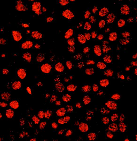TIMELESS Antibody - Detection of Human Timeless by Immunofluorescence. Sample: FFPE section of human breast carcinoma. Antibody: Affinity purified rabbit anti-Timeless used at a dilution of 1:400 (0.5 ug/ml). Detection: Red-fluorescent Goat anti-Rabbit IgG-heavy and light chain cross-adsorbed Antibody DyLight 594 Conjugated (A120-601D4) used at a dilution of 1:100.