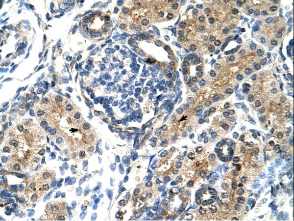 TIMELESS Antibody - Human Kidney.  This image was taken for the unconjugated form of this product. Other forms have not been tested.