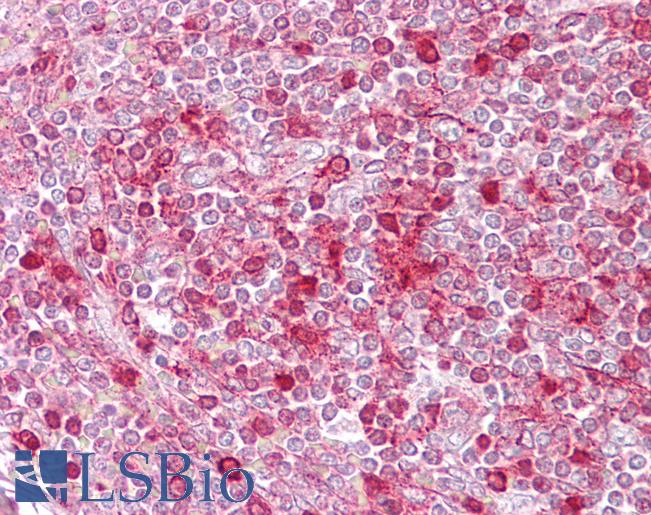 TIMELESS Antibody - Human Spleen: Formalin-Fixed, Paraffin-Embedded (FFPE).  This image was taken for the unconjugated form of this product. Other forms have not been tested.