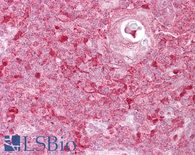 TIMELESS Antibody - Anti-TIMELESS antibody IHC of human thymus. Immunohistochemistry of formalin-fixed, paraffin-embedded tissue after heat-induced antigen retrieval. Antibody concentration 5 ug/ml.  This image was taken for the unconjugated form of this product. Other forms have not been tested.