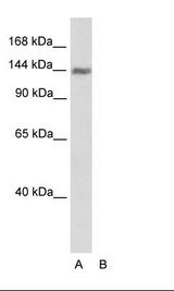 TIMELESS Antibody - Transfected 293T Cell Lysate.  This image was taken for the unconjugated form of this product. Other forms have not been tested.