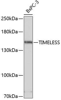 TIMELESS Antibody - Western blot analysis of extracts of BxPC-3 cells using TIMELESS Polyclonal Antibody at dilution of 1:3000.