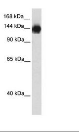 TIMELESS Antibody - Transfected 293T Cell Lysate.  This image was taken for the unconjugated form of this product. Other forms have not been tested.