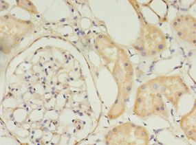 TIMM10 Antibody - Immunohistochemistry of paraffin-embedded human kidney using antibody at 1:100 dilution.  This image was taken for the unconjugated form of this product. Other forms have not been tested.
