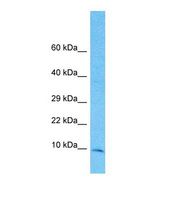 TIMM10 Antibody - Western blot of Human 721_B. TIMM10 antibody dilution 1.0 ug/ml.  This image was taken for the unconjugated form of this product. Other forms have not been tested.