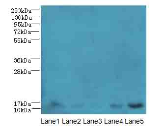 TIMM10B / FXC1 Antibody - Western blot. All lanes: TIMM10B antibody at 4 ug/ml. Lane 1: HeLa whole cell lysate. Lane 2: 293T whole cell lysate. Lane 3: HepG-2 whole cell lysate. Lane 4: K562 whole cell lysate. Lane 5: Mouse heart tissue. Secondary Goat polyclonal to Rabbit IgG at 1:10000 dilution. Predicted band size: 12 kDa. Observed band size: 12 kDa.