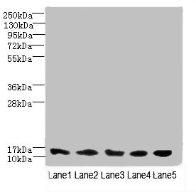 TIMM10B / FXC1 Antibody - Western blot All lanes: TIMM10B antibody at 4µg/ml Lane 1: Hela whole cell lysate Lane 2: 293T whole cell lysate Lane 3: HepG2 whole cell lysate Lane 4: K562 whole cell lysate Lane 5: Mouse heart tissue Secondary Goat polyclonal to rabbit IgG at 1/10000 dilution Predicted band size: 12 kDa Observed band size: 12 kDa